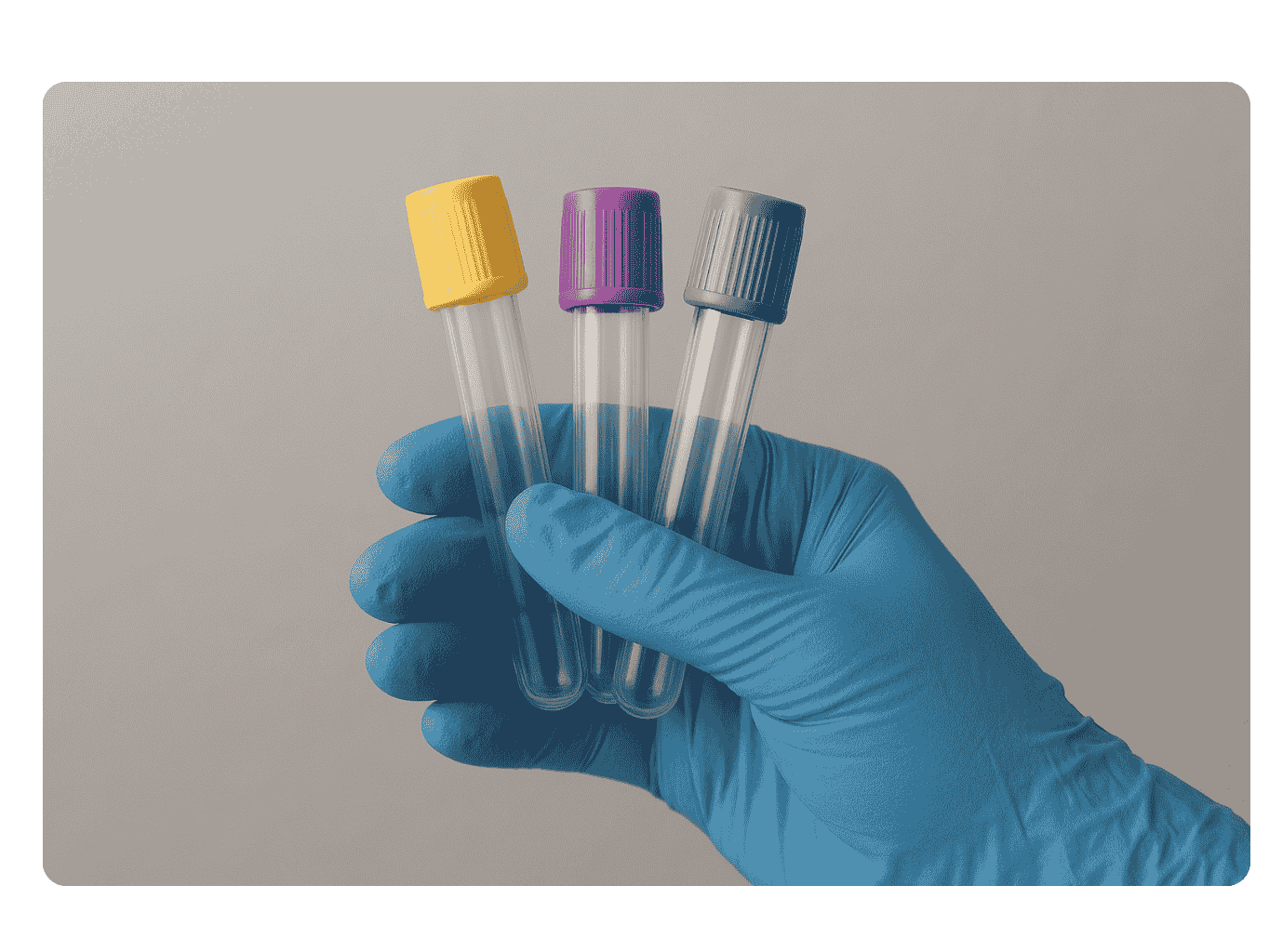 Zkumavky na odběr krve - sérum, EDTA, NaF